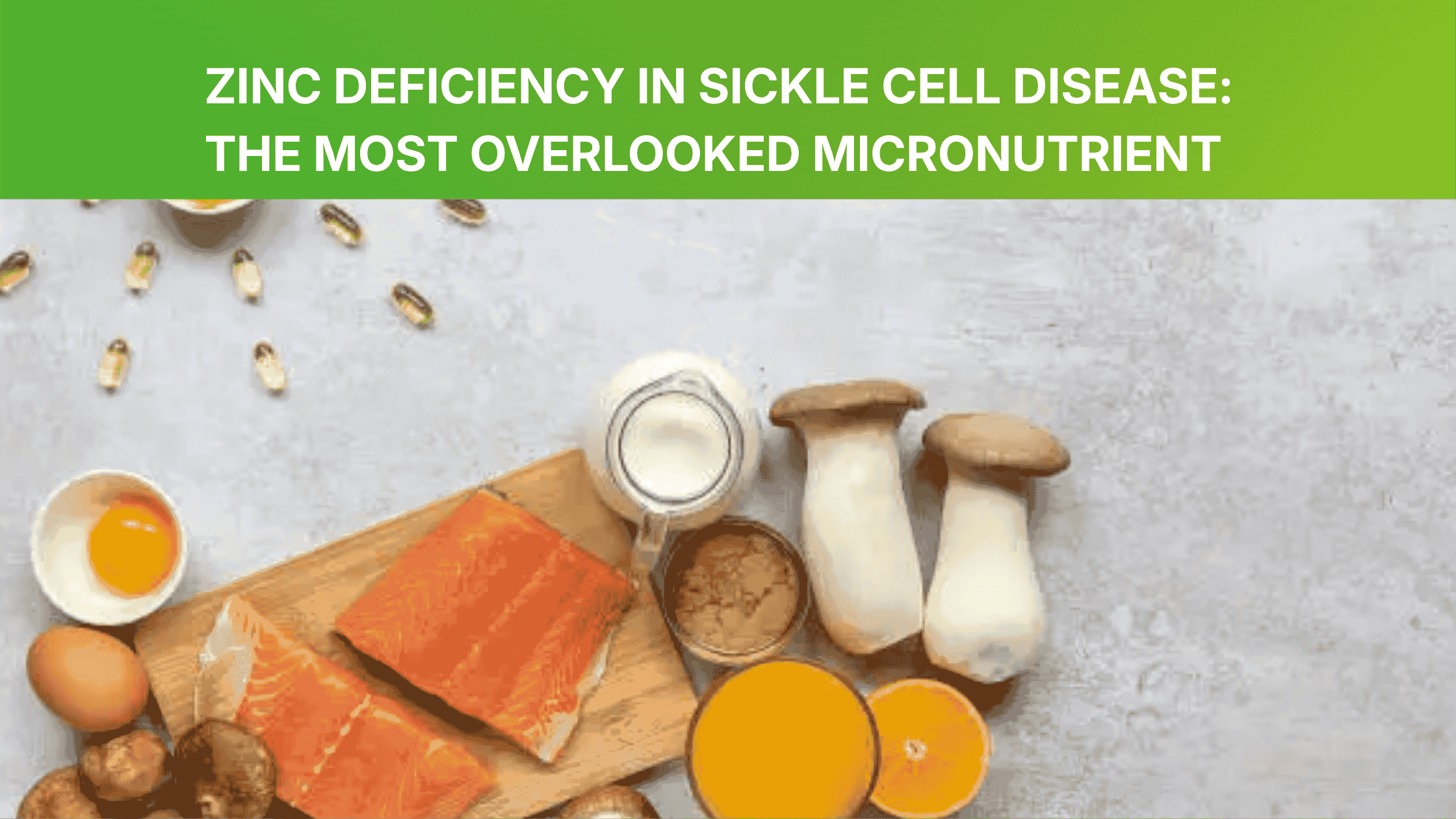 Zinc Deficiency in Sickle Cell Disease: The Most Overlooked Micronutrient